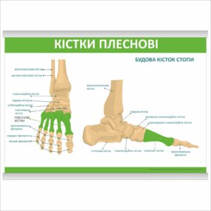 Плакат "Кістки плеснові" з планкою