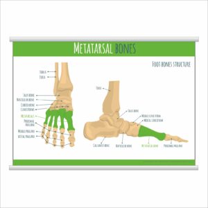 Плакат "Metatarsal bones" з планкою