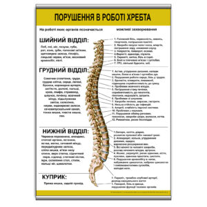 Плакат "Порушення в роботі хребта" з планкою