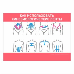 Плакат “Как использовать кинезиологическое ленты”