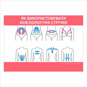 Плакат “Як використовувати кінезіологічні стрічки”
