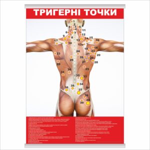 Плакат "Тригерні точки" з планкою