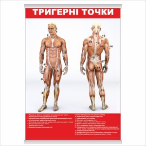 Плакат "Тригерні точки" з планкою