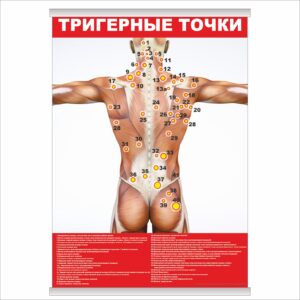 Плакат "Тригерные точки" з планкою