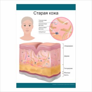 Плакат “Старая кожа”