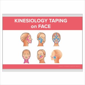 Плакат “Kinesiology taping on face” з планкою