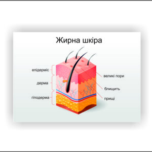 Плакат “Жирна шкіра” в медичний кабінет
