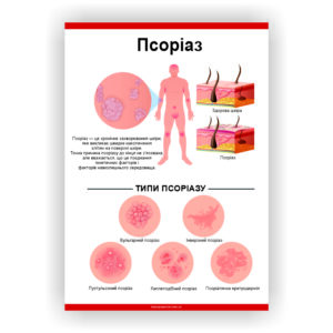 Плакат “Псоріаз”