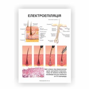 Плакат “Електроепіляція” майстру з епіляції