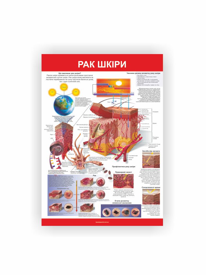 Плакат “Рак шкіри”
