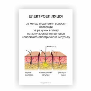 Плакат “Електроепіляція” майстру з епіляції