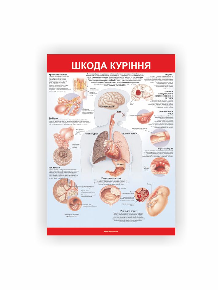 Плакат “Шкода куріння”
